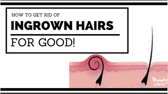 How To Get Rid Of Ingrown Hairs For Good The Beauty Clinic